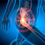 Hip Pain Treatment: Causes, Symptoms, and Advanced Care Options